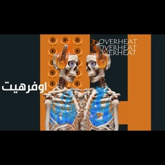 Over Heat FT Dawsha | أوفر هيت مع داوشة