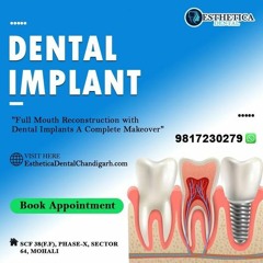 Discover Premium Dental Implants At Esthetica Dental Chandigarh