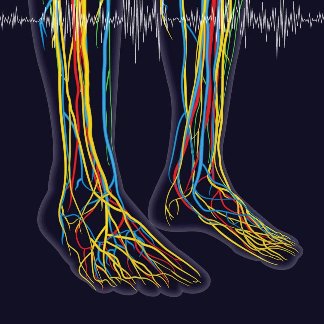 Rxfunction Walkasins Stream episode Measuring the Impact of a Wearable Sensory Prosthesis on ...