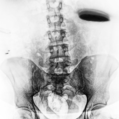 ray volpe x tynan - danger (goliath flip)