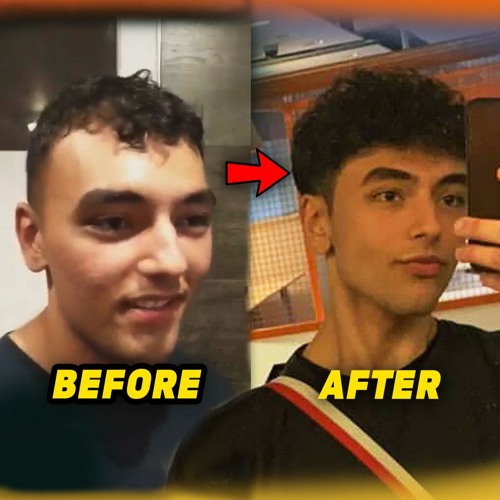 Stream Episode The Meat And Potatoes Hair Loss Prevention Stack Before And After By More Plates More Dates Podcast Listen Online For Free On Soundcloud