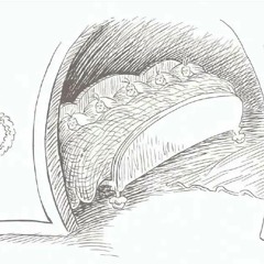 So Cold/ Jacket Improv