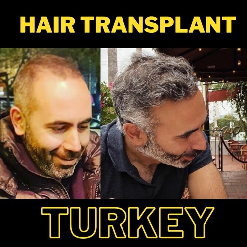 Stream episode Can I Wear A Cap After A Hair Transplant by Ekim Nazım Kaya  podcast | Listen online for free on SoundCloud