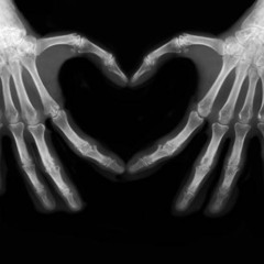 I Don't Want To Be x Twisted Bone