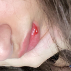 👅👅