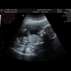 媽呀！我要當媽了！！！feat. Blue麥克風