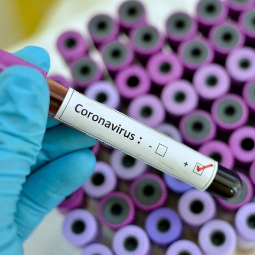 Stream RDCCoronavirus le message du ministre de la santé by ACTUALITE