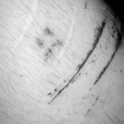 bu kişisel bir intihar w/ @renethsoaway