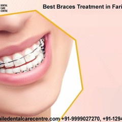 Dental Braces Treatment in Faridabad India At Smile Dental Care Centre