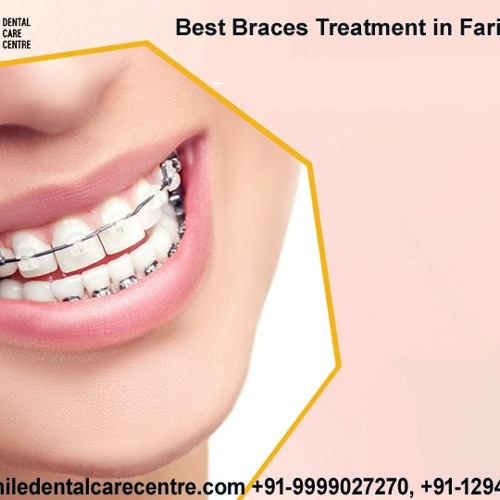 Dental Braces Treatment in Faridabad India At Smile Dental Care Centre
