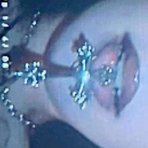 Joyas