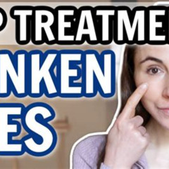 Best Treatment For Sunken Under Eyes Reviews