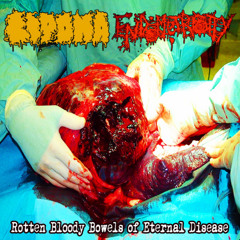 15 years of Cancerous Misery - Lipoma