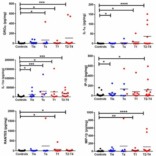 Stream episode Oncotarget Novel Urine Protein Biomarkers In Bladder
