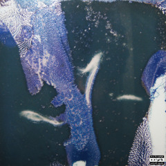 Unregulated Amygdala Volume