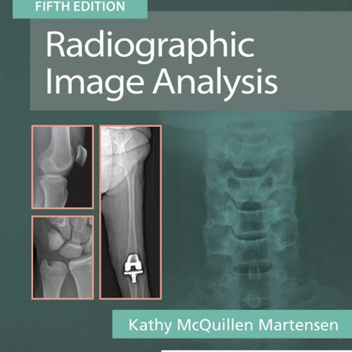 Stream PDF READ Radiographic Image Analysis E-Book from Berkobalamin ...