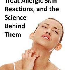 [READ] EPUB KINDLE PDF EBOOK 7 Home Remedies to Treat Allergic Skin Reactions, and th