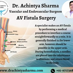 Understanding AV Fistula Surgery