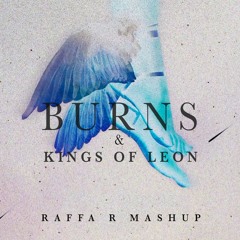 BURNS - Talamanca vs. Kings of Leon (RAFFA R Mashup)
