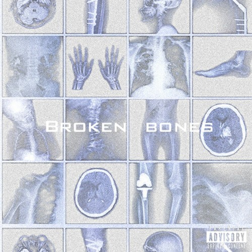 Broken Bones (feat. Deyaz)