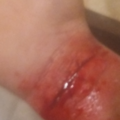 BLOOd .yungmexicanbih