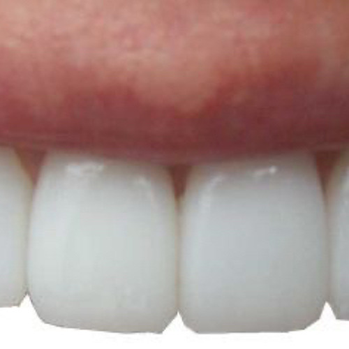 Zickenautomat-50Min of BAMBAMBAM