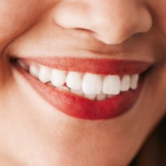 Common Misconceptions About Teeth Whitening in Palm Desert