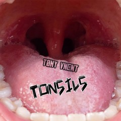 TONSILS