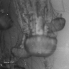DISCOMEDUSAE