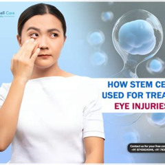 Best Stem Cell Eye Treatment Reviews