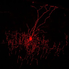 Neuropathic Pain Minimix