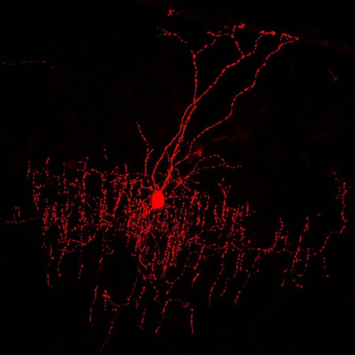 Neuropathic Pain Minimix