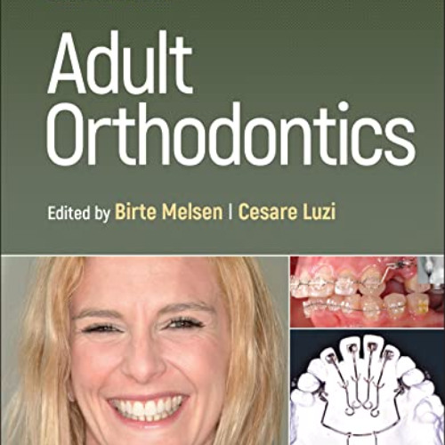 [ACCESS] EPUB 💞 Adult Orthodontics by  Birte Melsen &  Cesare Luzi [KINDLE PDF EBOOK