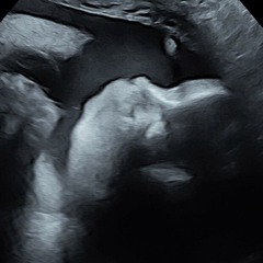 so hard to get through - SAMIII's PARADE