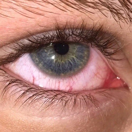 Why U Blind (feat.кристиназз)