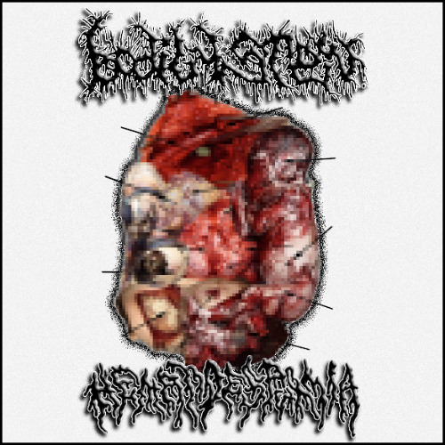 NECROTIZING ENTEROCOLITIS