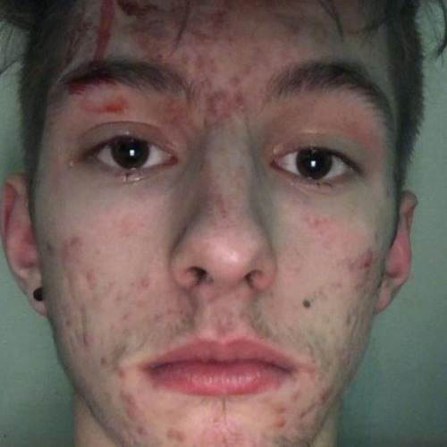 DaMirel - Spritz da an guaden Tekk oida (ft. Svensense)