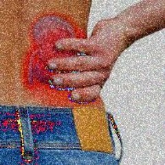 Kidney Stones