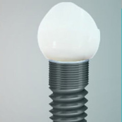 The Step-by-Step Guide to Getting Dental Implants in Raleigh