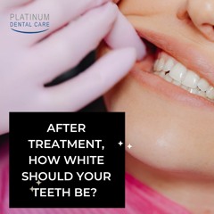 After Treatment How White Should Your Teeth Be