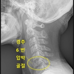 모가지 나가는 믹셋