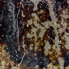 YERSINIA PESTIS