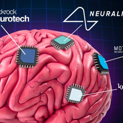 Brain Chip