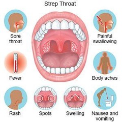 strep throat