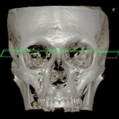 the noises I hear (preview)