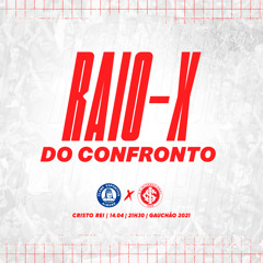 Raio-X #17 | Aimoré x Internacional, entrevista com Matheus Beck | 13/04/21