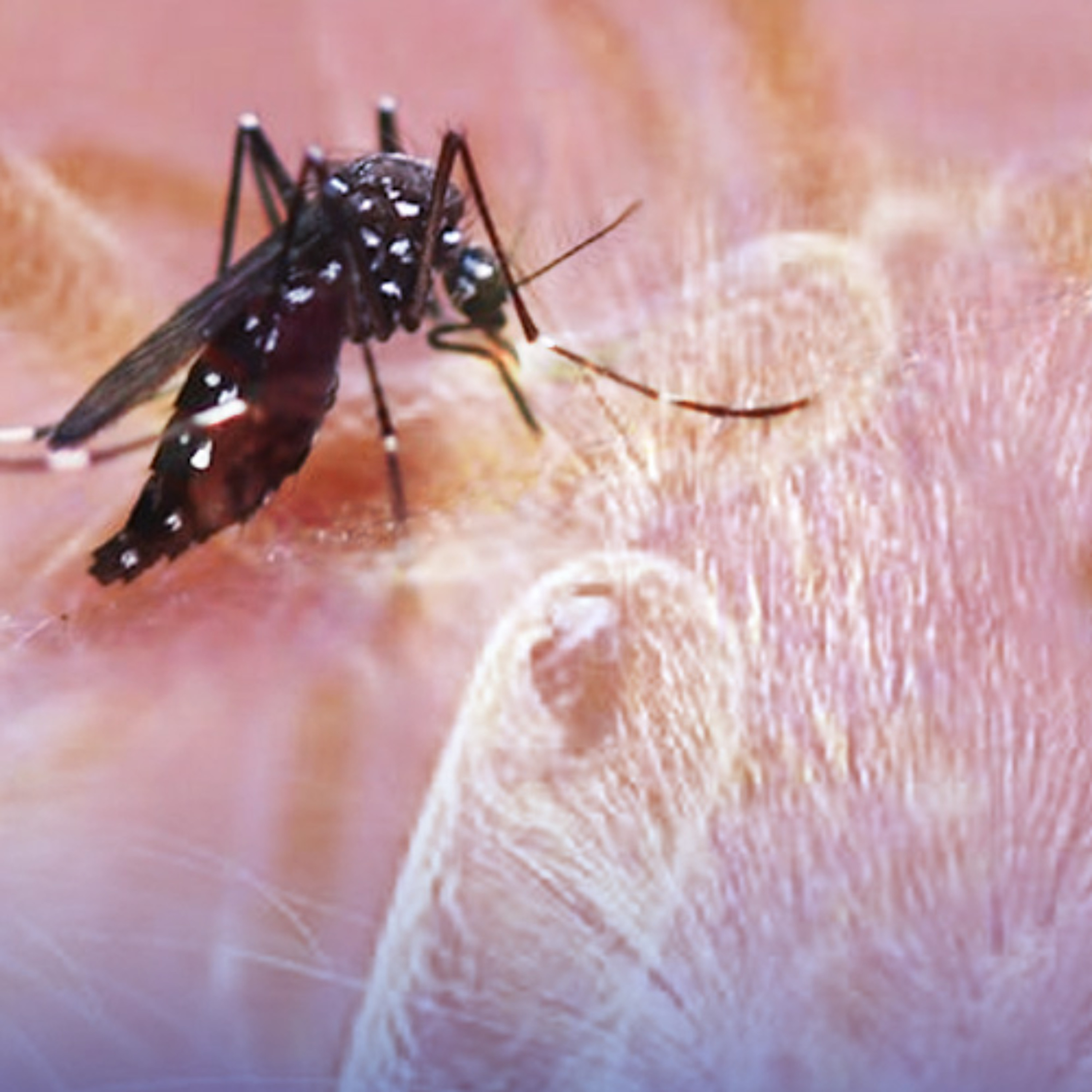 Santé publique : un nouveau cas de leptospirose recensé ; près de 80 cas de chikungunya enregistrés chaque jour