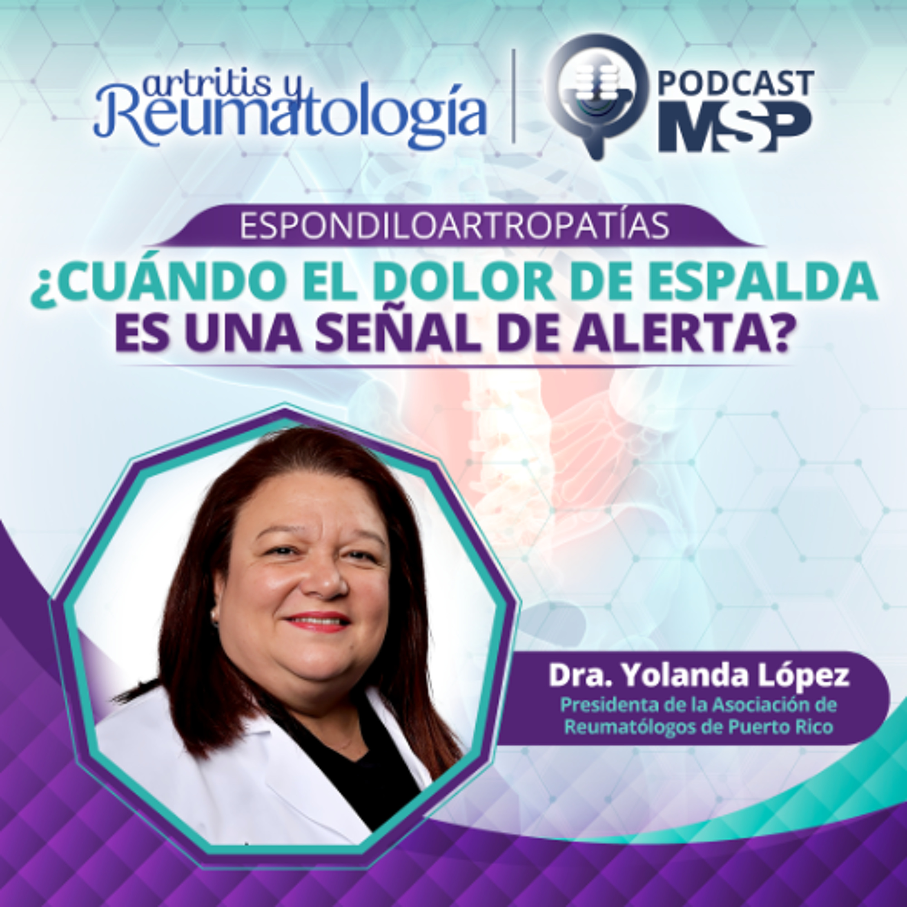 Espondiloartropatías: ¿Cuándo el dolor de espalda puede ser una señal de alerta? episode artwork