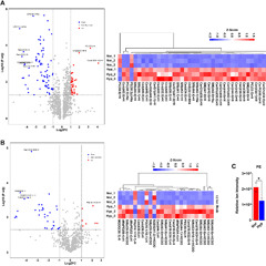 Prostate Cancer Cells Survive Treatment by Storing Fat in Low Oxygen Conditions