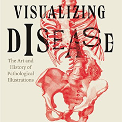 [Read] EBOOK 📂 Visualizing Disease: The Art and History of Pathological Illustration